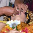 tooth filing 04