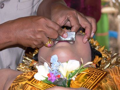 tooth filing 11